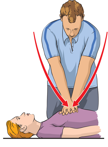 Kỹ thuật ép ngực