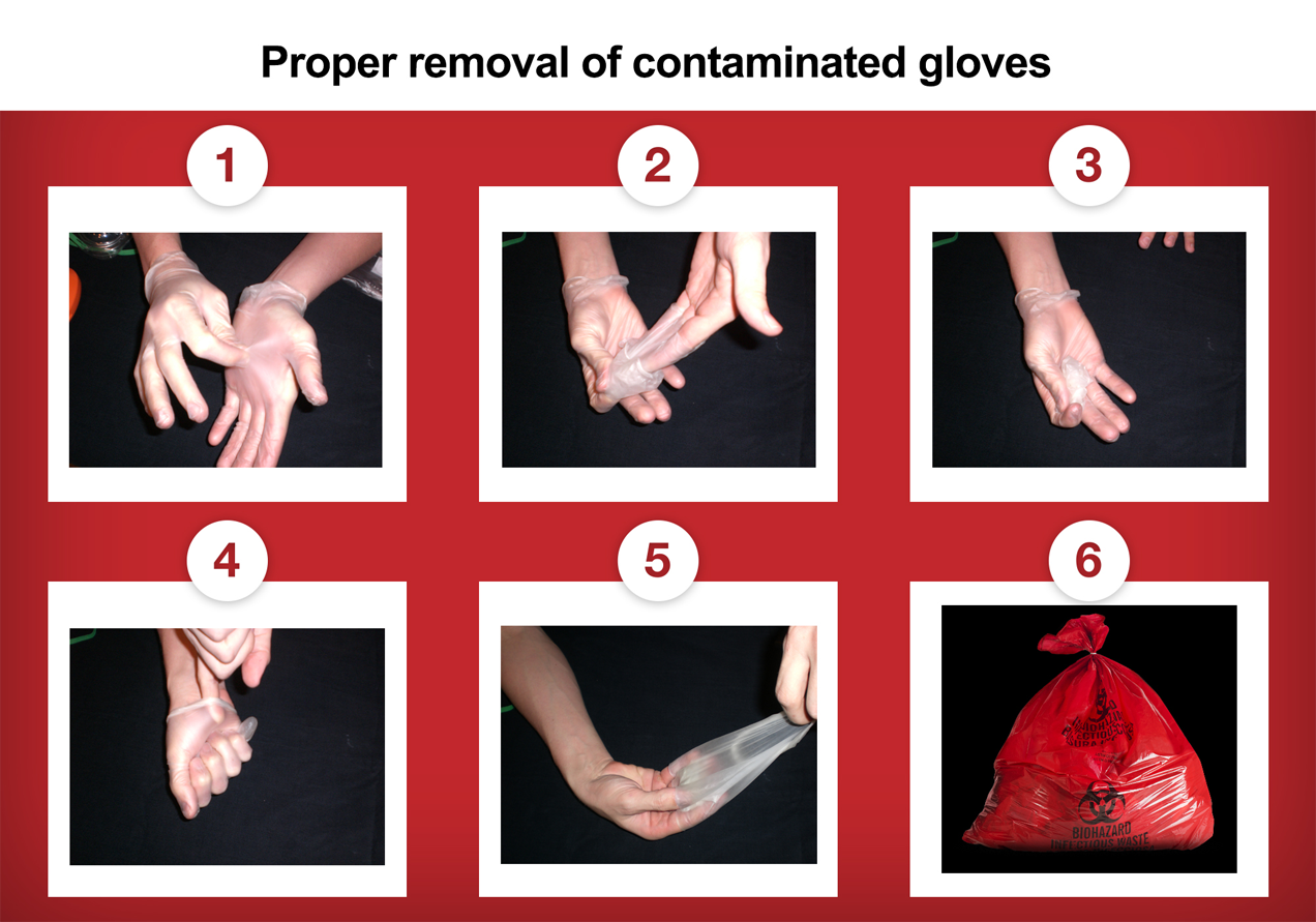 Cách tháo găng tay