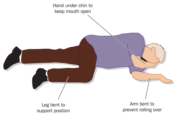 Tư thế hồi phục bước 1