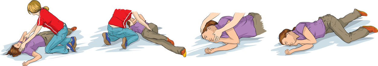 Tư thế hồi phục bước 2